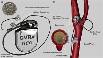 Non-clinical and Pre-clinical Testing to Demonstrate Safety of the Barostim Neo Electrode for Activation of Carotid Baroreceptors in Chronic Human Implants